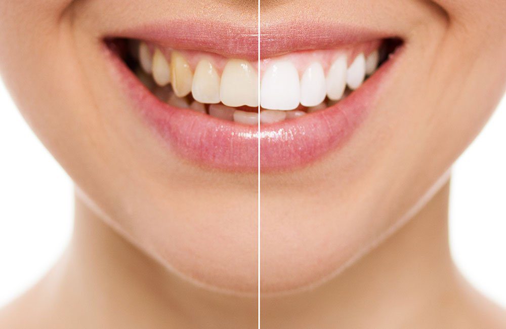 cosmetic Cosmetic Dentistry - April 2025