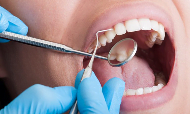 Dental Scaling Treatment - February 2023