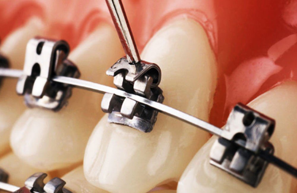 Orthodontics - March 2023