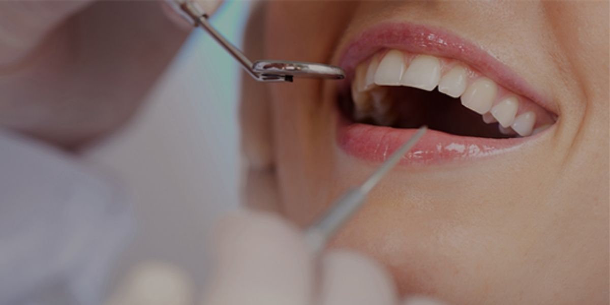 Periodontics Treatment