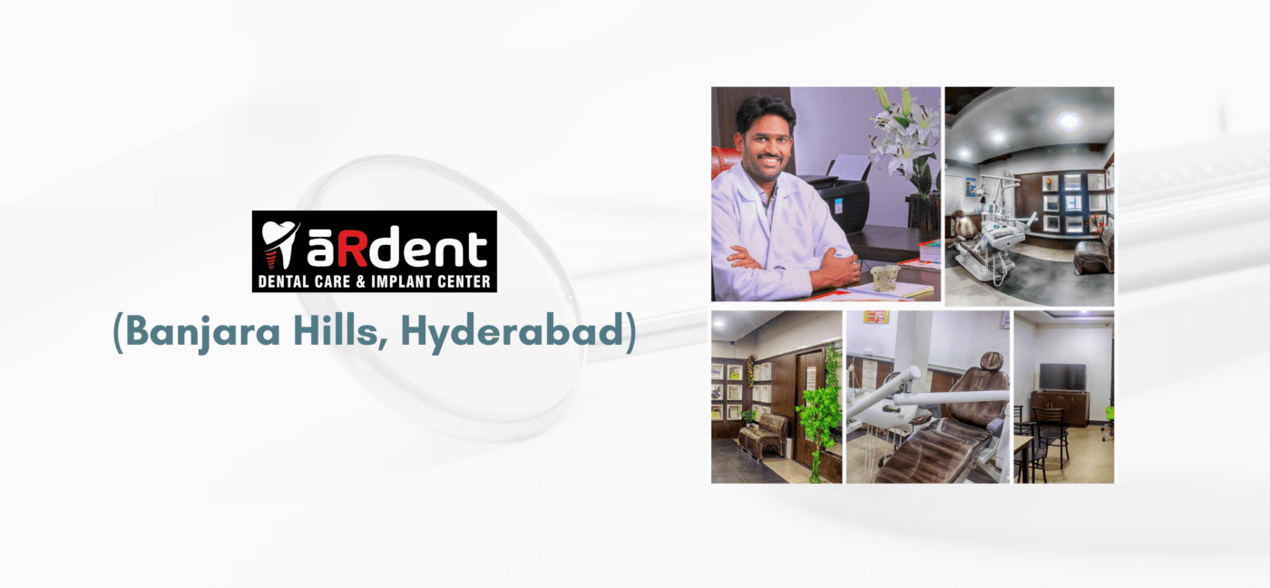 Best Dental Care in Hyderabad -2