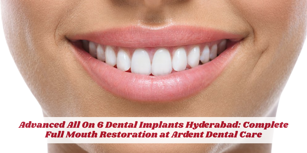 All On 6 dental implants | full mouth restoration | permanent teeth in 48 hours | same day dental implants | advanced implantology | best dental implant clinic