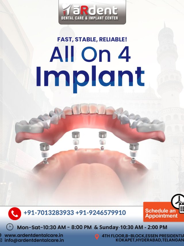 Get Full Mouth Dental Implants at aRdent – Restore Your Smile in Just 2 Days