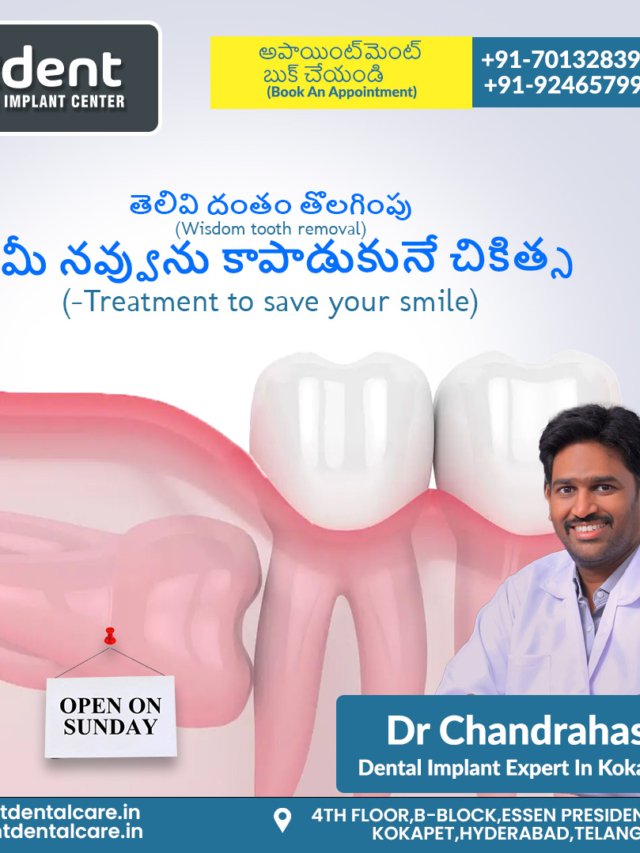 Best Dentist in Hyderabad: Transform Your Smile with Expert Care